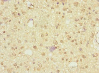 Polyclonal Rabbit anti-Human NRXN3 Antibody (IHC, WB)