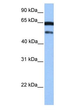 Polyclonal Rabbit anti-Human ZSCAN5B Antibody (aa429-478, WB)
