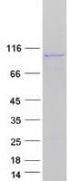 Human CTNNB1 / Beta Catenin Protein (Recombinant Myc-DDK (Flag))