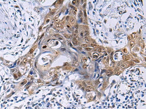Polyclonal Rabbit anti-Human THOC3 Antibody (IHC)