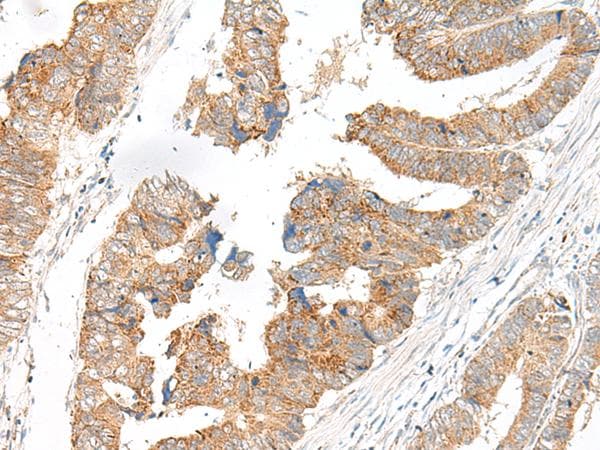 SLC6A9 / GLYT1 Antibody
