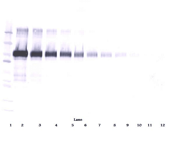 VCAM1 / CD106 Antibody
