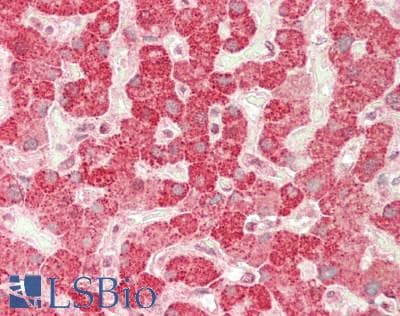 IHC-plus™ TGFA / TGF Alpha Antibody