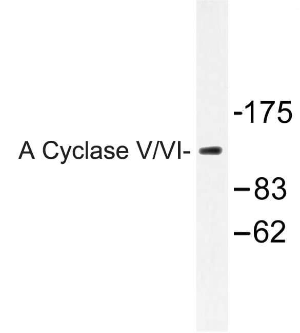ADCY5+6 Antibody (Phe1052)