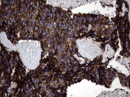 DDOST / OST48 Antibody (aa131-378, clone OTI1C1)