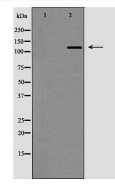 Polyclonal Rabbit anti-Human EGF Antibody (IHC, WB)