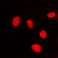 LMNA / Lamin A+C Antibody (Internal)