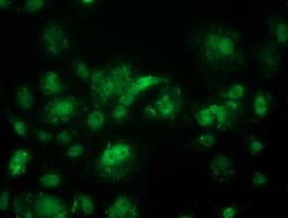 ACY3 Antibody (clone OTI2D5, Carrier-free)