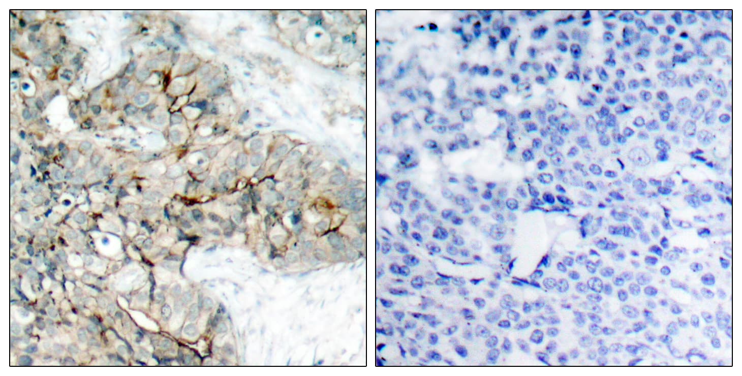 ITGB3 / Integrin Beta 3 / CD61 Antibody (phospho-Tyr773)
