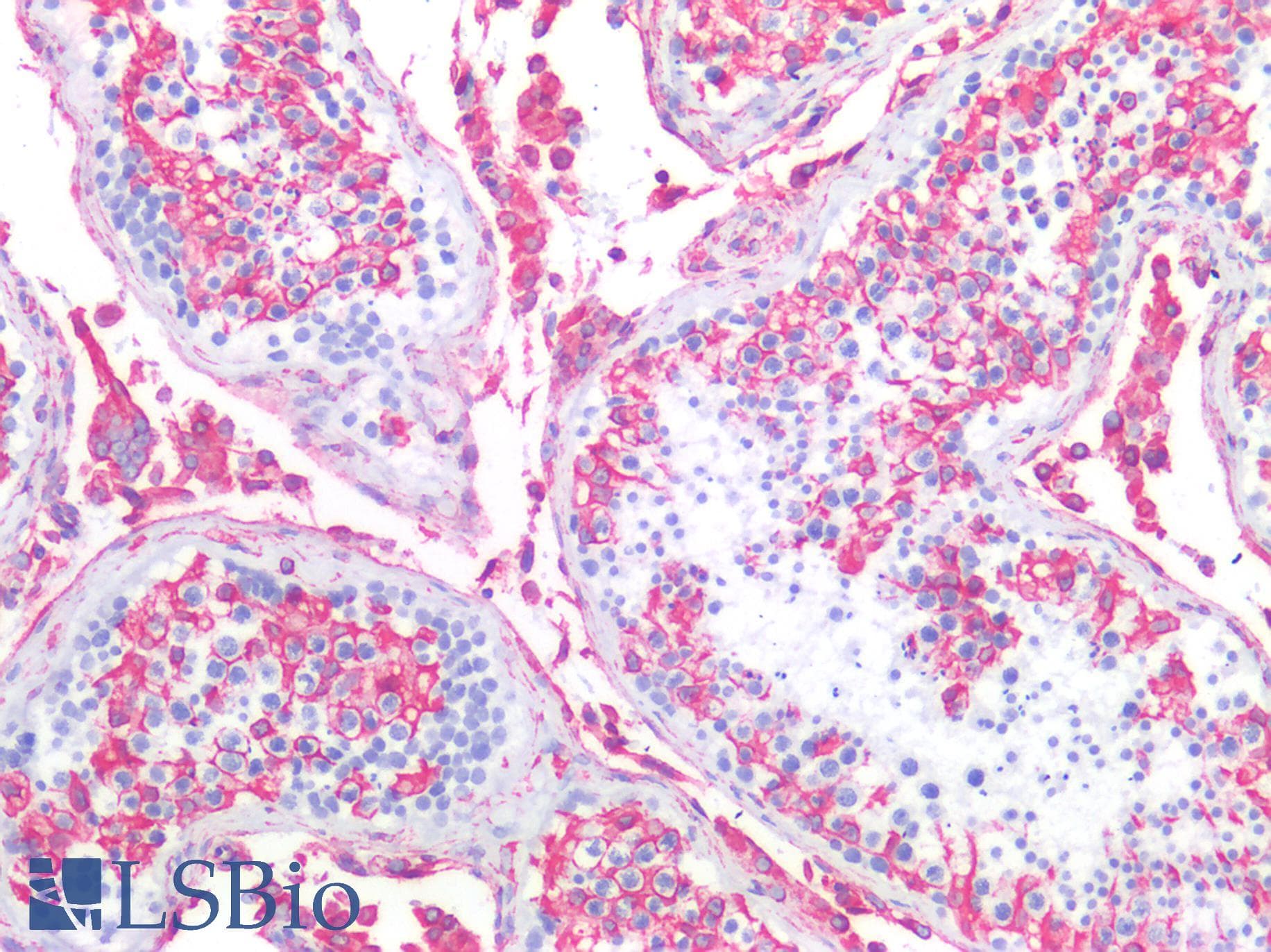 PathPlus™ Vimentin Antibody