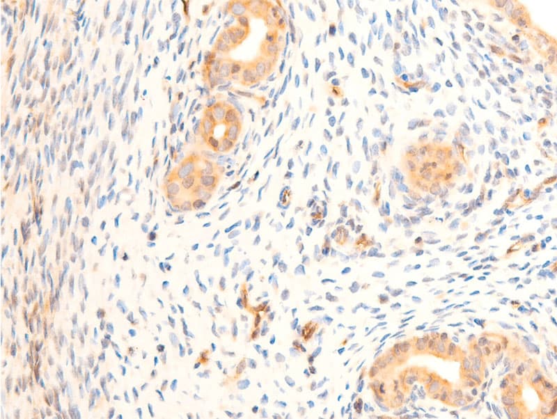 HSPB6 / HSP20 Antibody (phospho-Ser16)