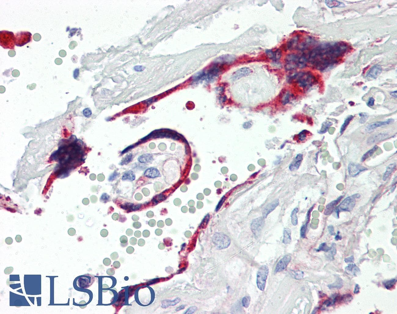 IHC-plus™ Vasohibin 1 / VASH1 Antibody (clone 4A3)