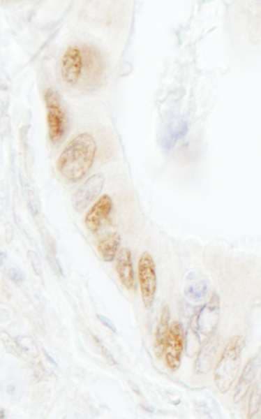 LIG1 / DNA Ligase 1 Antibody (aa200-250)