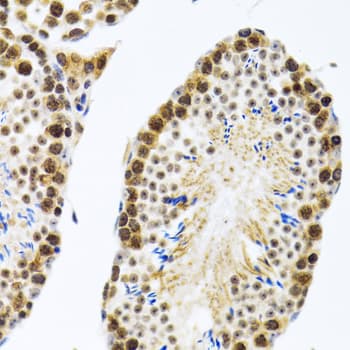 Polyclonal Rabbit anti-Human CIRP / CIRBP Antibody (IHC, IF, WB)