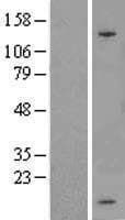 SPINK1 Protein (Over-Expression Lysate Myc-DDK (Flag))