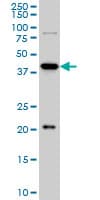 IHC-plus™ YY1 Antibody (clone 2C4)