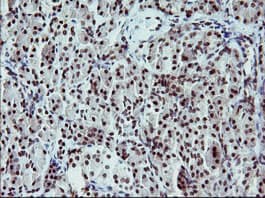 TP73 / p73 Antibody (clone OTI2H5)