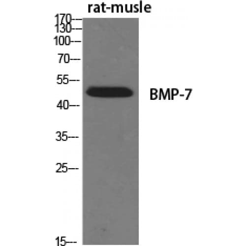 Polyclonal Rabbit anti-Human BMP7 Antibody (Internal, IHC, WB)