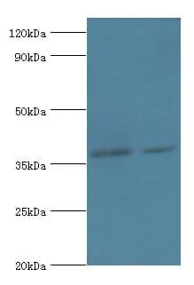 DHRS7 Antibody (aa29-339)