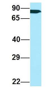 ARHGAP22 / RhoGAP2 Antibody (aa573-622)