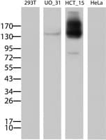 ABCB1 / MDR1 / P Glycoprotein Antibody (clone OTI2F7)