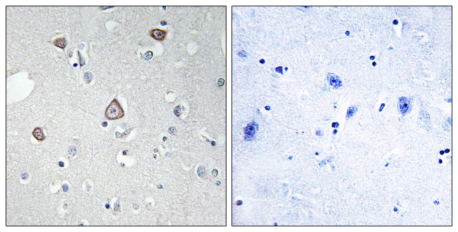 GRM2 / MGLUR2 Antibody (aa241-290)
