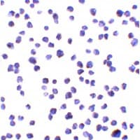 C9orf72 / ALSFTD Antibody