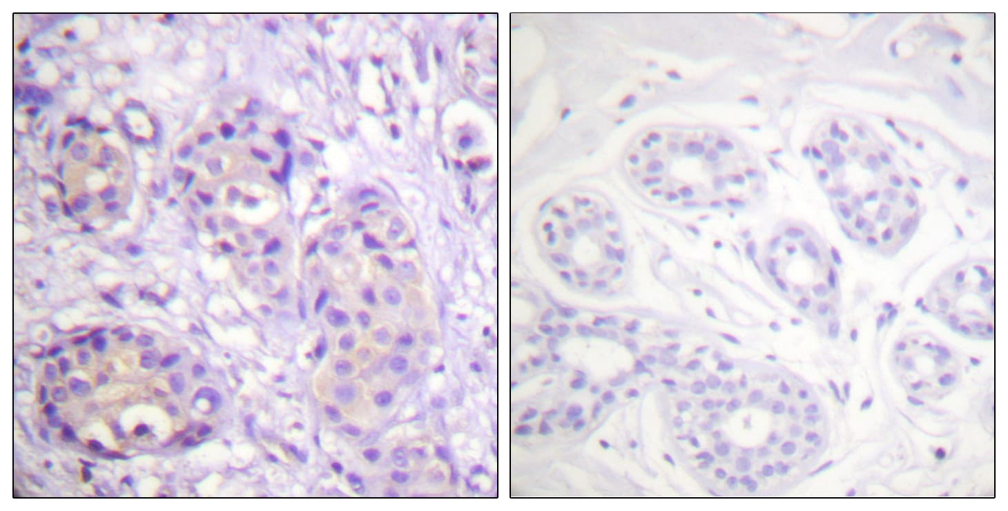 IKBKB / IKK2 / IKK Beta Antibody (phospho-Tyr199)