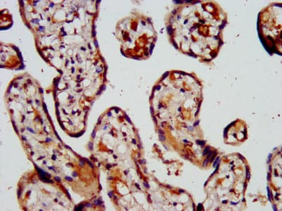Polyclonal Rabbit anti-Human CAPS2 Antibody (IHC, WB)