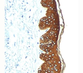 Basic Cytokeratin AE3 Antibody (clone AE3, Ready-to-Use)