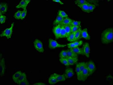 Polyclonal Rabbit anti-Human NCAM2 Antibody (IHC, WB)