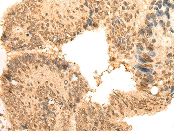 Polyclonal Rabbit anti-Human Translokin / CEP57 Antibody (IHC, WB)