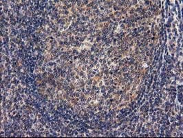 RASSF1 / RASSF1A Antibody (clone OTI2B11)