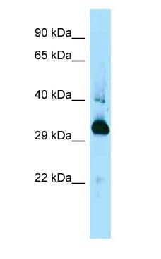 MAPRE1 / EB1 Antibody (C-Terminus)