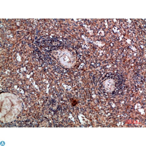 Polyclonal Rabbit anti-Human HLA-DQA1 Antibody (IHC)