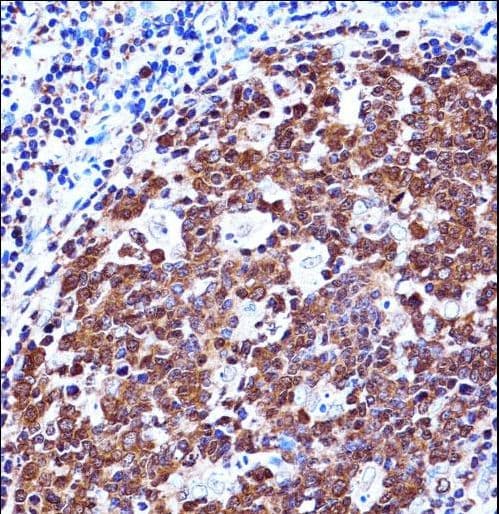 ZAP70 Antibody (aa276-304)