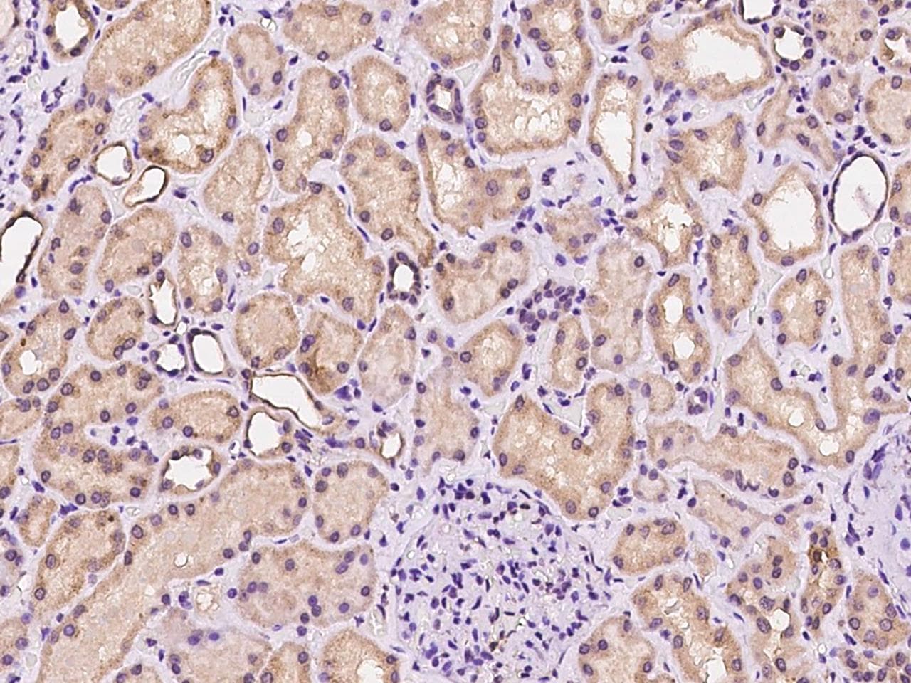 NDRG4 Antibody