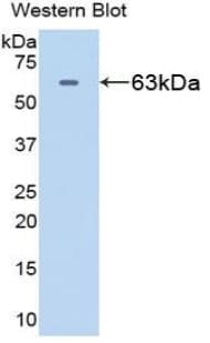 HSPD1 / HSP60 Antibody (aa1-573)