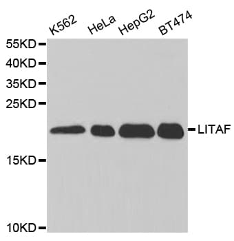 Polyclonal Rabbit anti-Human LITAF Antibody (IHC, IF, WB)