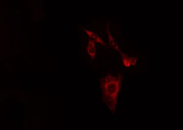 CA3 / Carbonic Anhydrase III Antibody