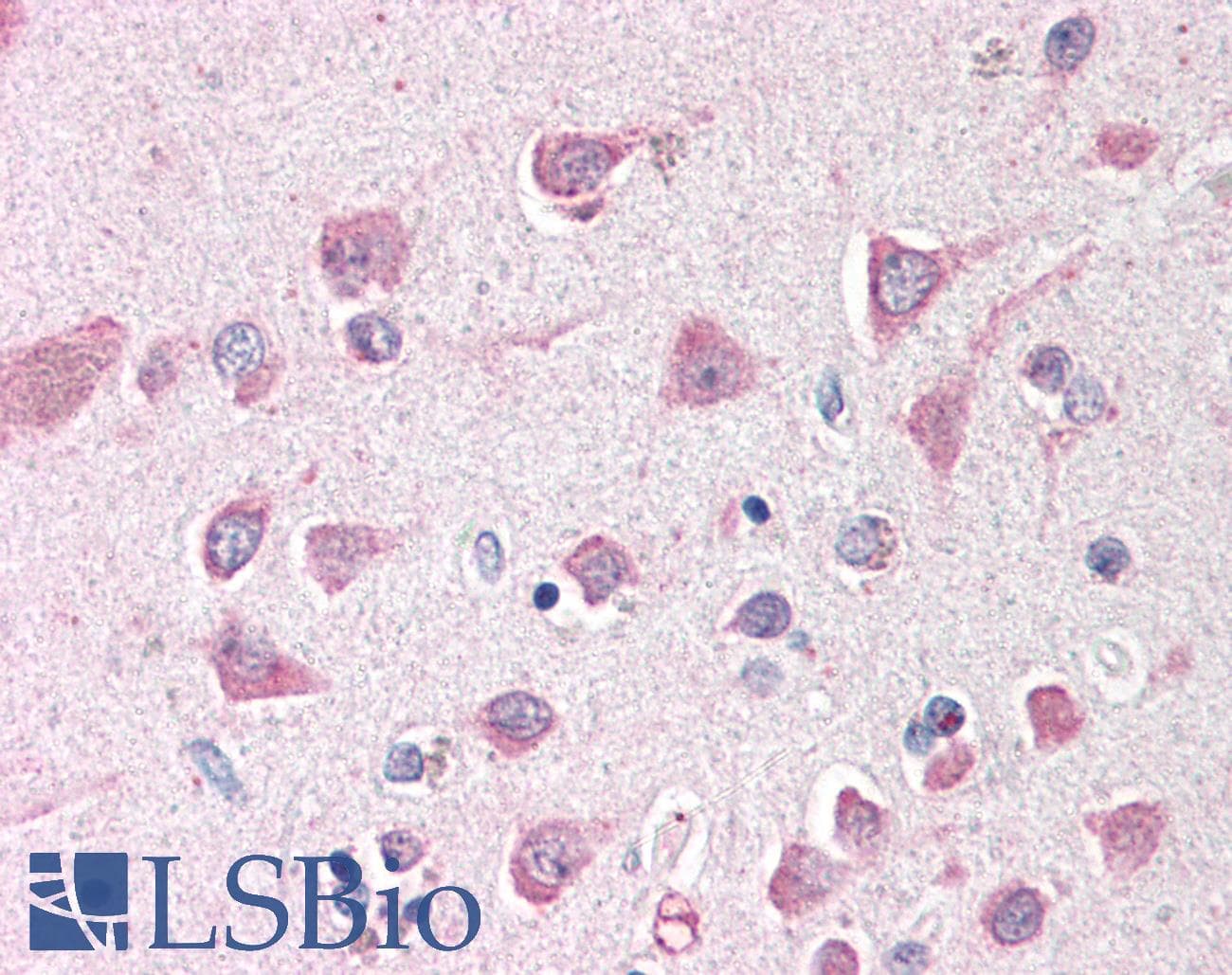 IHC-plus™ Polyclonal Goat anti-Human ING3 Antibody (aa285-310, IHC, WB)