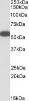 IHC-plus™ GLUD1/Glutamate Dehydrogenase Antibody (aa93-107)