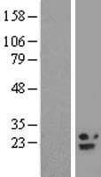 Human B9D2 Protein (Over-Expression Lysate Myc-DDK (Flag))