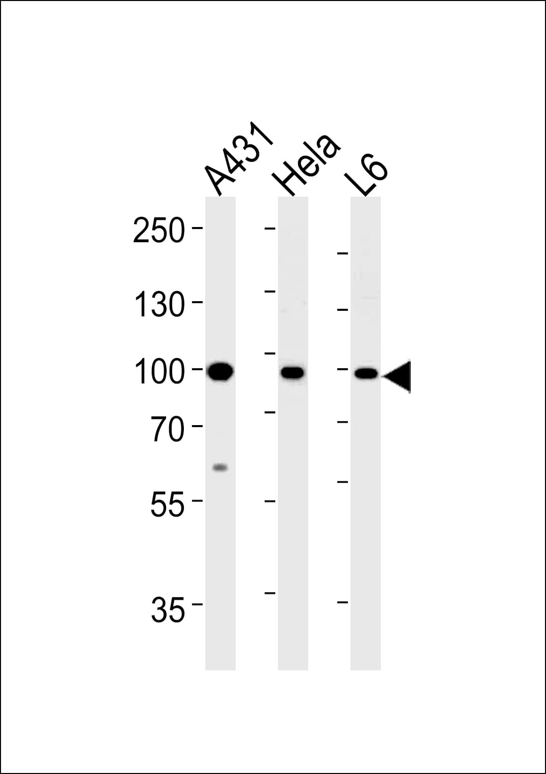 HSP90AB1 / HSP90 Alpha B1 Antibody (aa438-465)