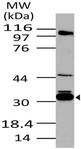 IHC-plus™ SFN / Stratifin / 14-3-3 Sigma Antibody