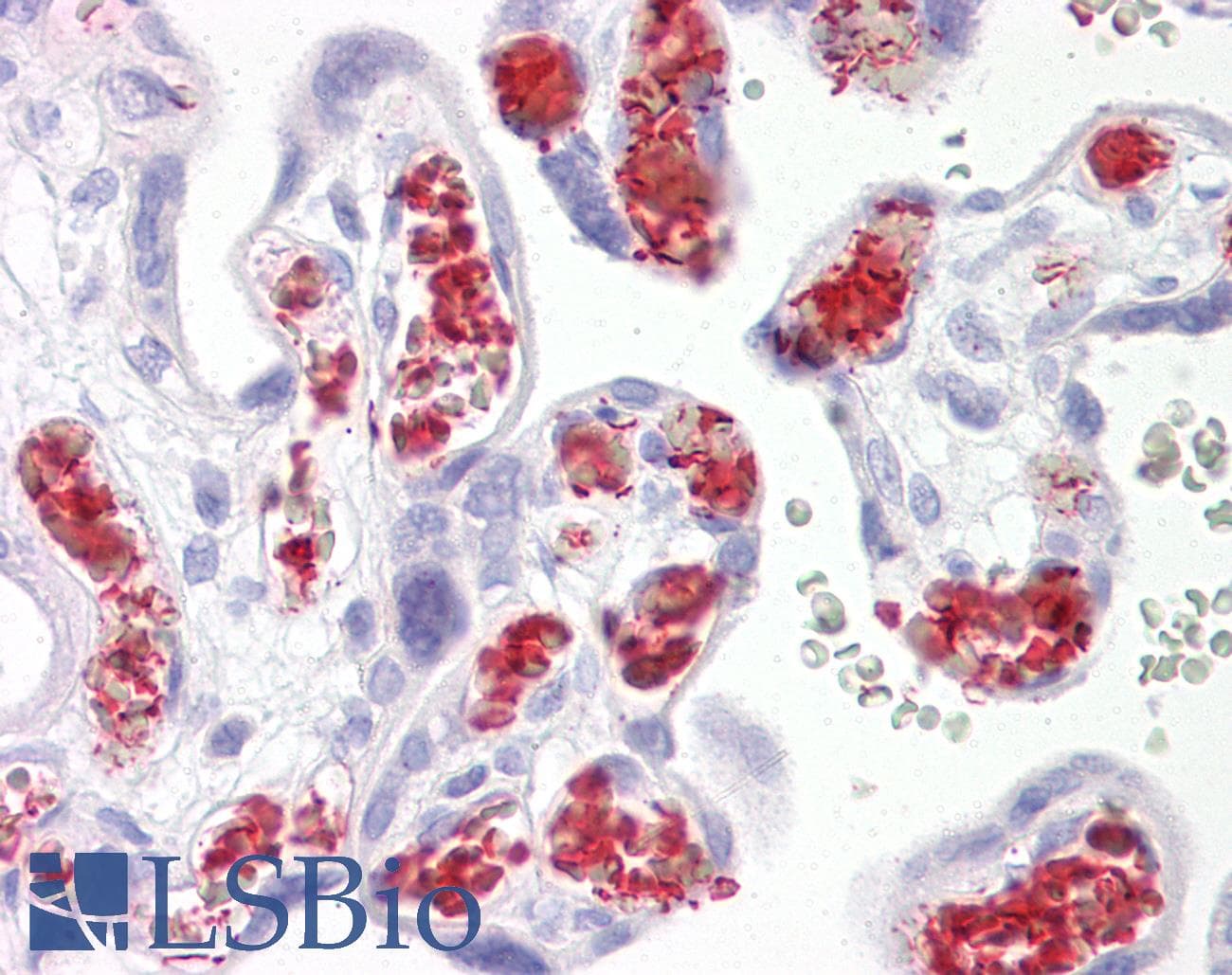 IHC-plus™ Polyclonal Rabbit anti-Human TBKBP1 Antibody (aa300-350, IHC, WB)