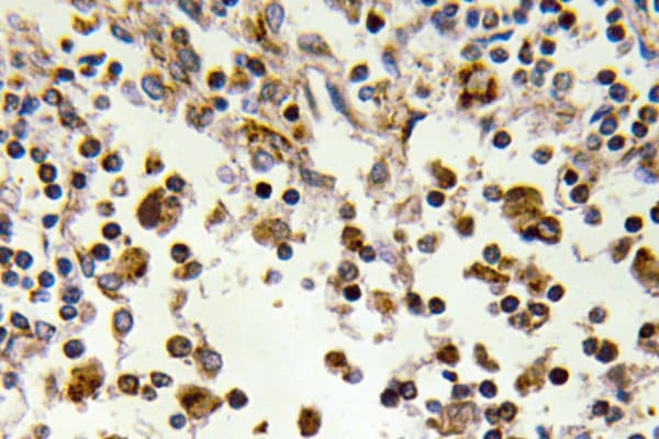 Polyclonal Rabbit anti-Human RPS6KA5 / MSK1 Antibody (Gln577, IHC, IF, WB)