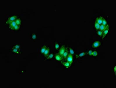 Polyclonal Rabbit anti-Human FAM168B Antibody (IHC)