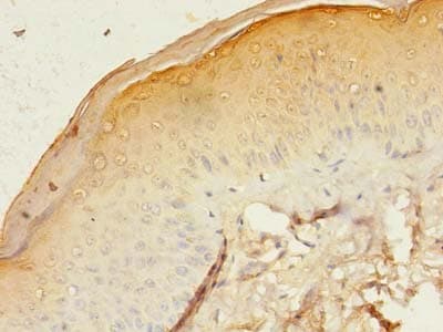 Polyclonal Rabbit anti-Human GJB3 / CX31 / Connexin 31 Antibody (aa211-270, IHC, WB)