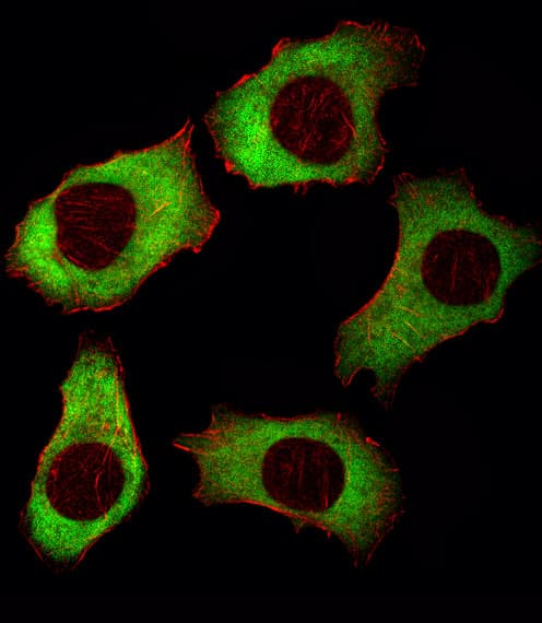 YBX1 / YB1 Antibody (aa149-178)